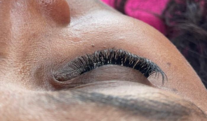 Ajuda a realizar um sonho comprar uma maca de estética 