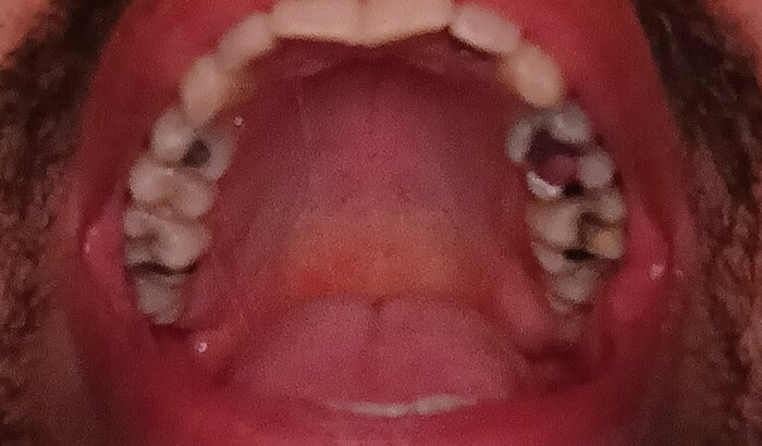 Vakinha do Sorriso