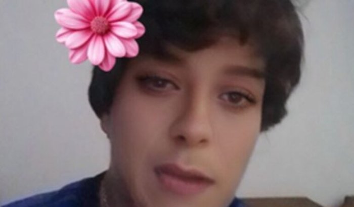 Ajude a Juliana a continuar seu tratamento contra a distonia generalizada