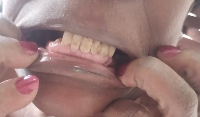 ajudar a fazer a dentadura da minha colega