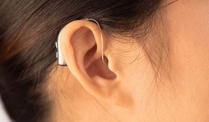 Meu sonho minha audição. Vakinha para aparelho auditivo deficiente. 