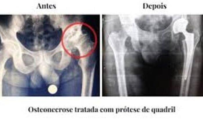 Pãozão precisa da nossa ajuda agora para voltar a andar! 🆘