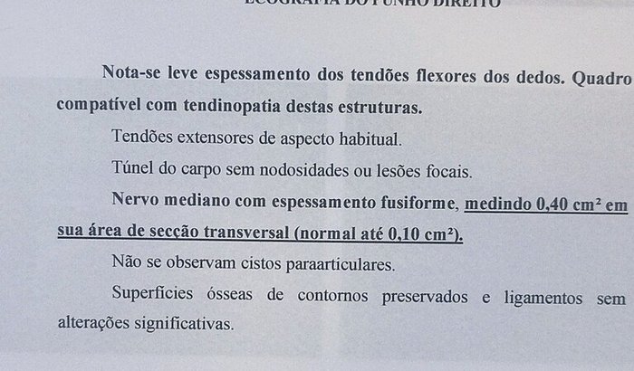 Ajuda para cirurgia de Túnel do carpo