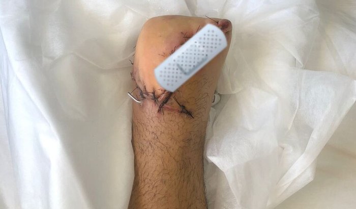 Ajuda para a recuperação do Arthur 