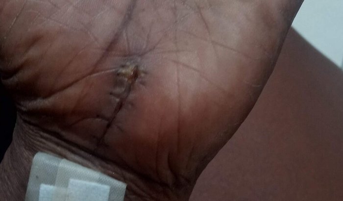 Auxilio no tratamento em meu afastamento pelo inss