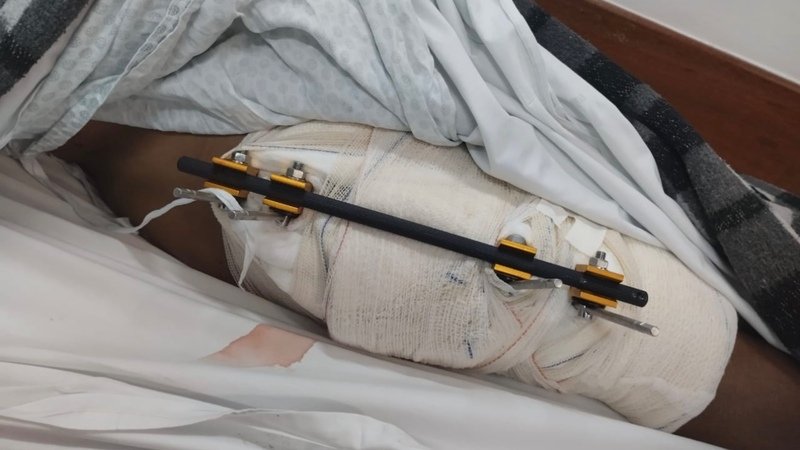 imagem da vaquinha Ajude na recuperação de Italo e Nayara.