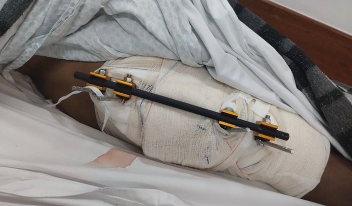 Ajude na recuperação de Italo e Nayara.