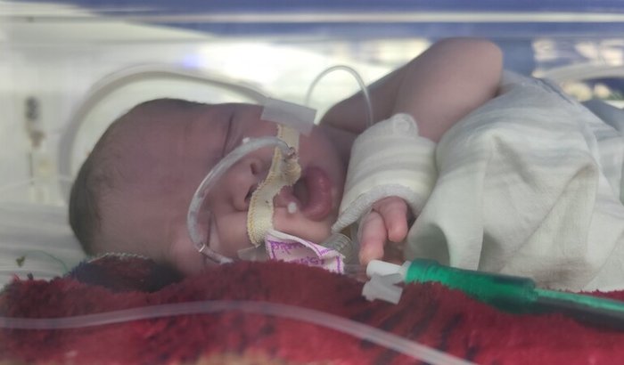 Ajude a Ana Alice UTI neonatal 
