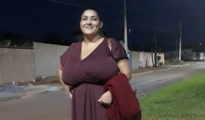 Cirurgia de redução de mama