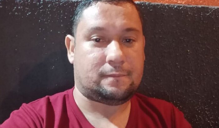 Cirurgia de artroplastia total do dois lado do quadril