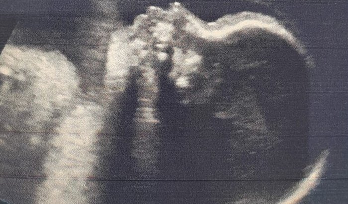 Comprar Enxoval da Isabella