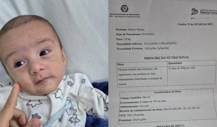 Fundos para Alimentação APLV DO Matteo e cuidados 