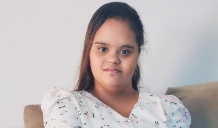 Ajude a Duda no tratamento de  tumor raro em maxilar