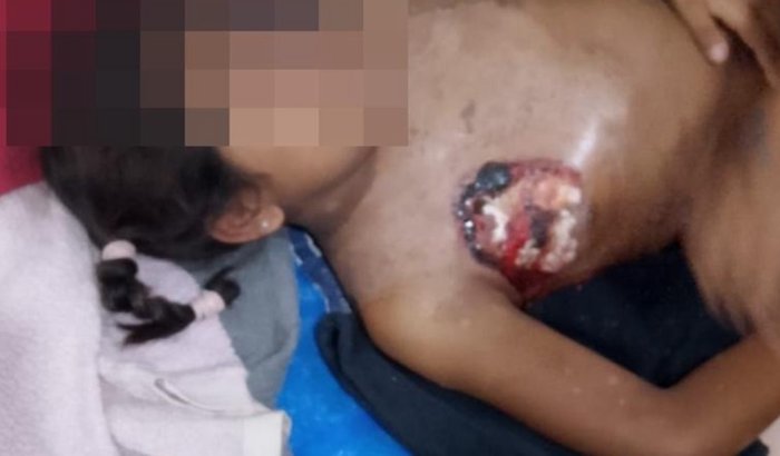 Ajude a salvar as crianças Warao da fome e desnutrição 