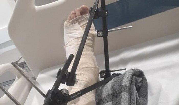 ACIDENTE DE MOTO!!! PAGAR ALUGUEL E ALIMENTAÇÃO