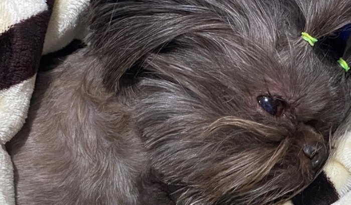 Cirurgia da Jade ( pedra na bexiga )