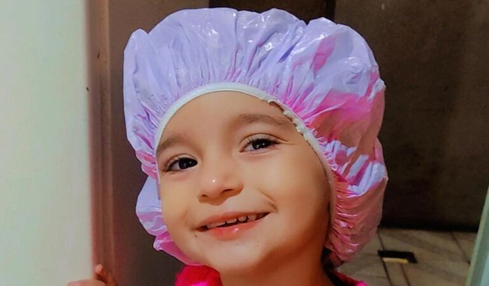 Cirugia da catarata congênita da vitoria Emanuelly