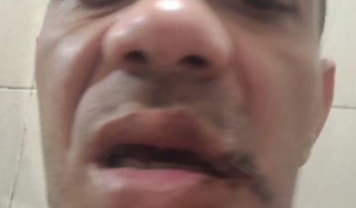 Ajude o Will Rock’s a Sorrir e Trabalhar Novamente