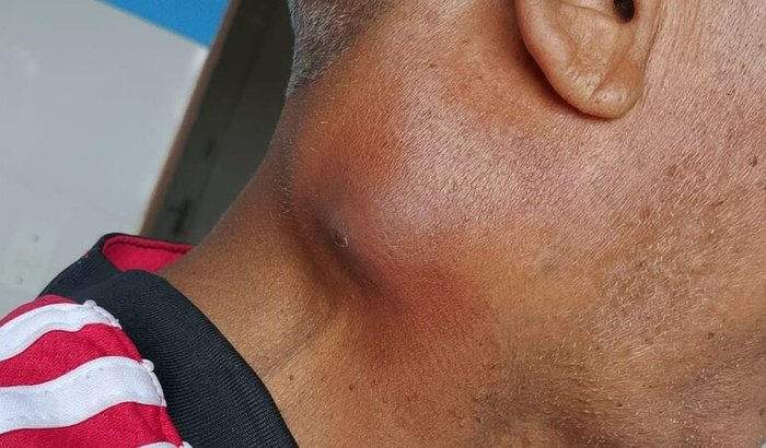 Ajude o Francisco a Viver – Cirurgia Urgente!