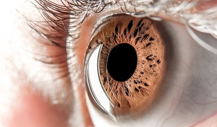 Cirurgia Glaucoma - Renatta Rabello