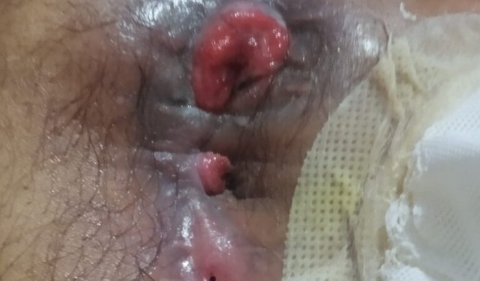 MEDICAMENTOS QUIMIOTERAPIA URGENTE