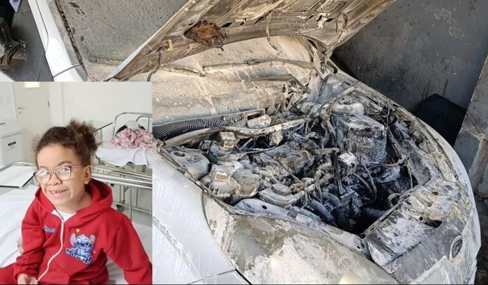 Minha filha tem uma doença rara e nosso carro pegou fogo