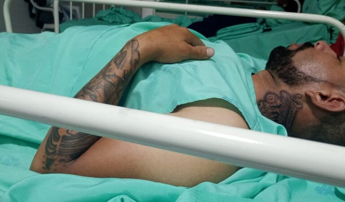 Comprar um colete ortopédico para o meu irmão 
