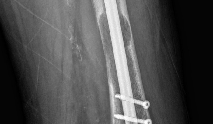 Tratamento e Cuidados Clovis Turco