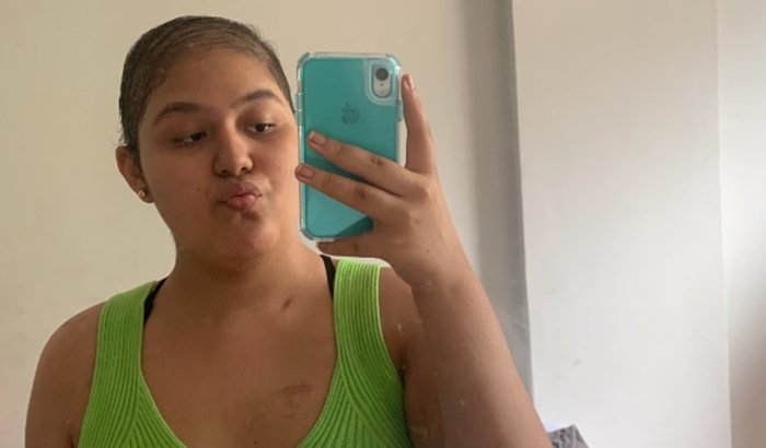 Me ajude a  fazer cirurgia de prótese de quadril.