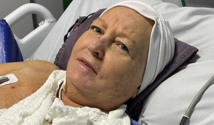 Ajuda tratamento de Câncer