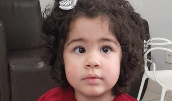 Cirurgia de Estrabismo Maitê Vitória