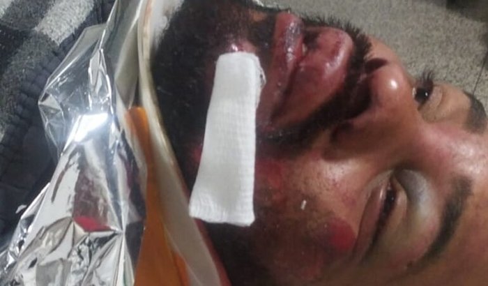 Ajude na recuperação do Marcos