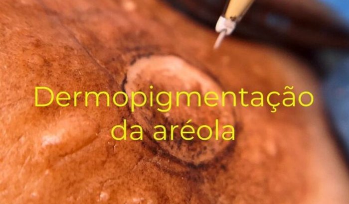 Curso de tatuagem paramédica e equipamentos