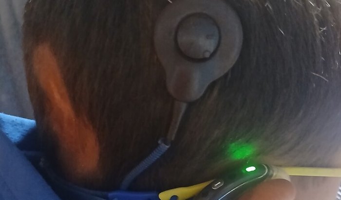 Ajudem o meu lorenzo a voltar a ouvir com os aparelhos