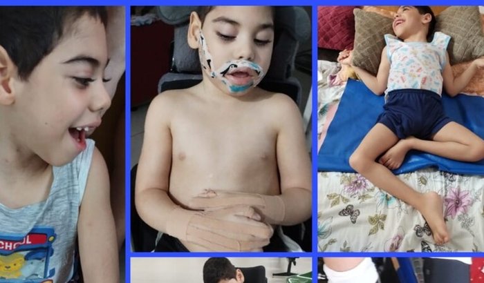 Ajuda o pequeno Ryan a conquistar mais qualidade de vida.