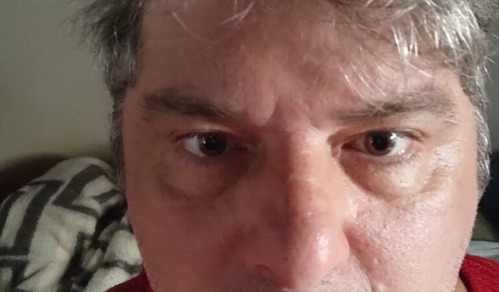 ME AJUDEM A VIVER MELHOR: REABILITAÇÃO MOTORA POR NEUROMODULAÇÃO TRANSCRANIANA PÓS AVC ISQUÊMICO