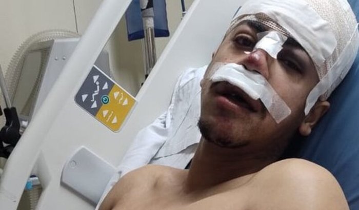 Ajude Marcos a se recuperar de seu grave acidente