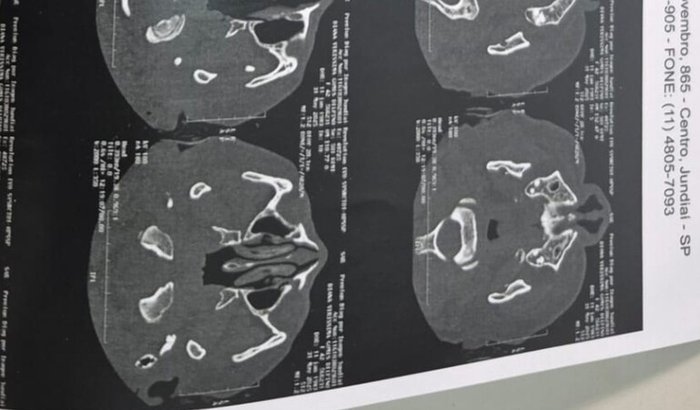 Todos juntos pela Diana