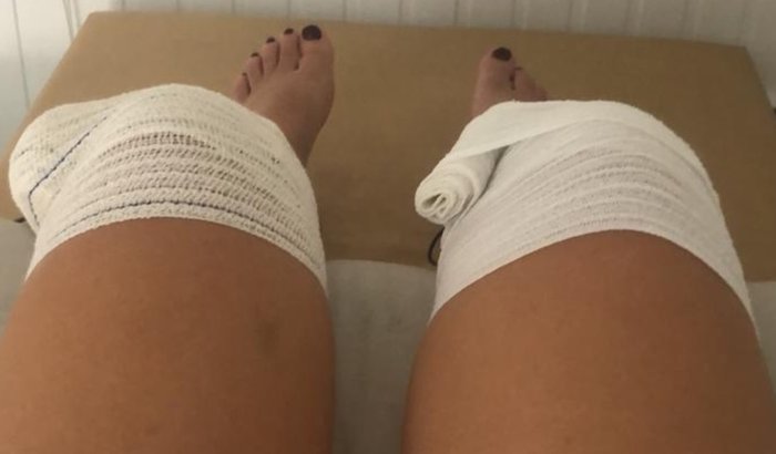 Cirurgia nos Joelhos: Contamos com sua ajuda!