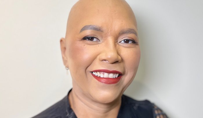 Ajude a pagar a cirurgia oncológica de Denilza Luiza