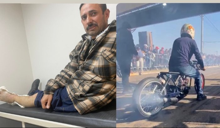 Ajuda para cirurgia de Frances