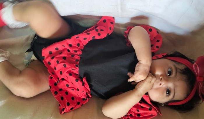 Tratamento da minha neném Naiara Valentína