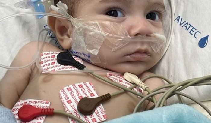 Ajude o Bernardo a vencer a cardiopatia rara e continuar o tratamento , ate a cirugia