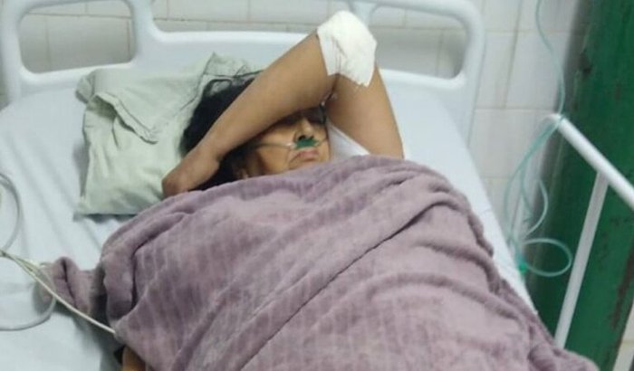 TRATAMENTO AVC HEMORRÁGICO ZAINEITE