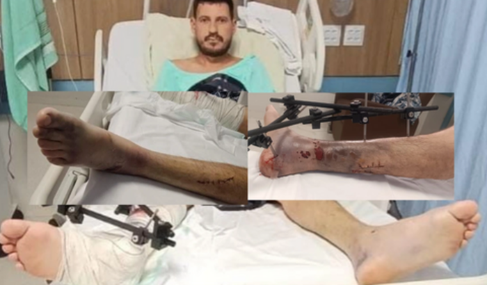 Vaquinha solidária entre amigos para ajudar o Wilson