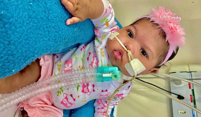 Cardiopatia congênita Ana Liz