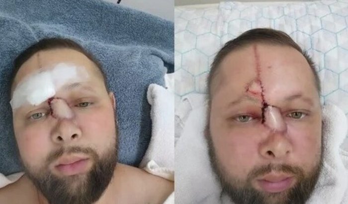 TRATAMENTO CANCER JOAQUIM