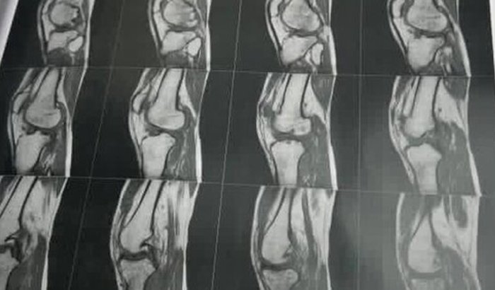 Ajuda pra fazer minha cirurgia de joelho 🙏🏻