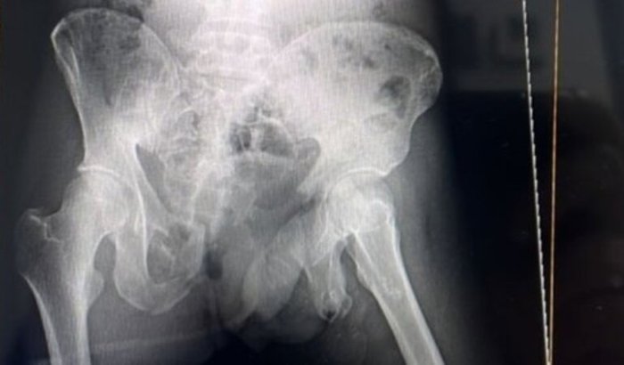 RADIOLOGIA DO AMOR, EM FAVOR DO FILHO DE UMA COLEGA DA ÁREA.