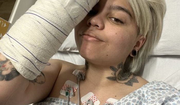 Tratamento e cirurgia de emergência pós acidente